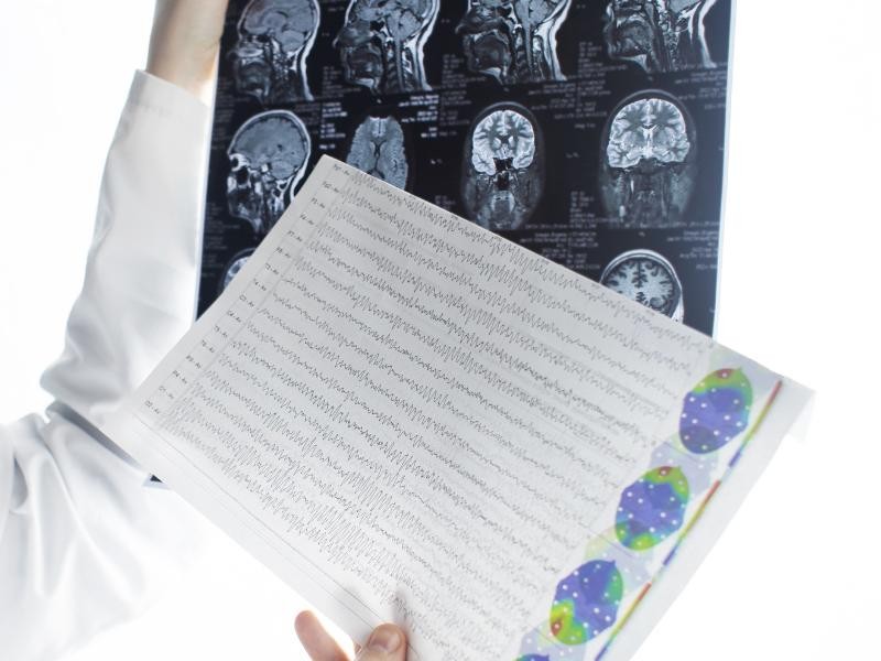 Eletroencefalograma com Mapeamento