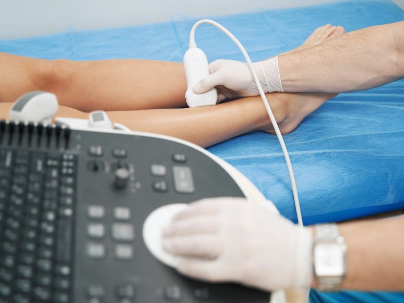 Ultrassom Doppler Venoso do Membro Inferior