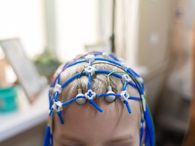 Eletroencefalograma